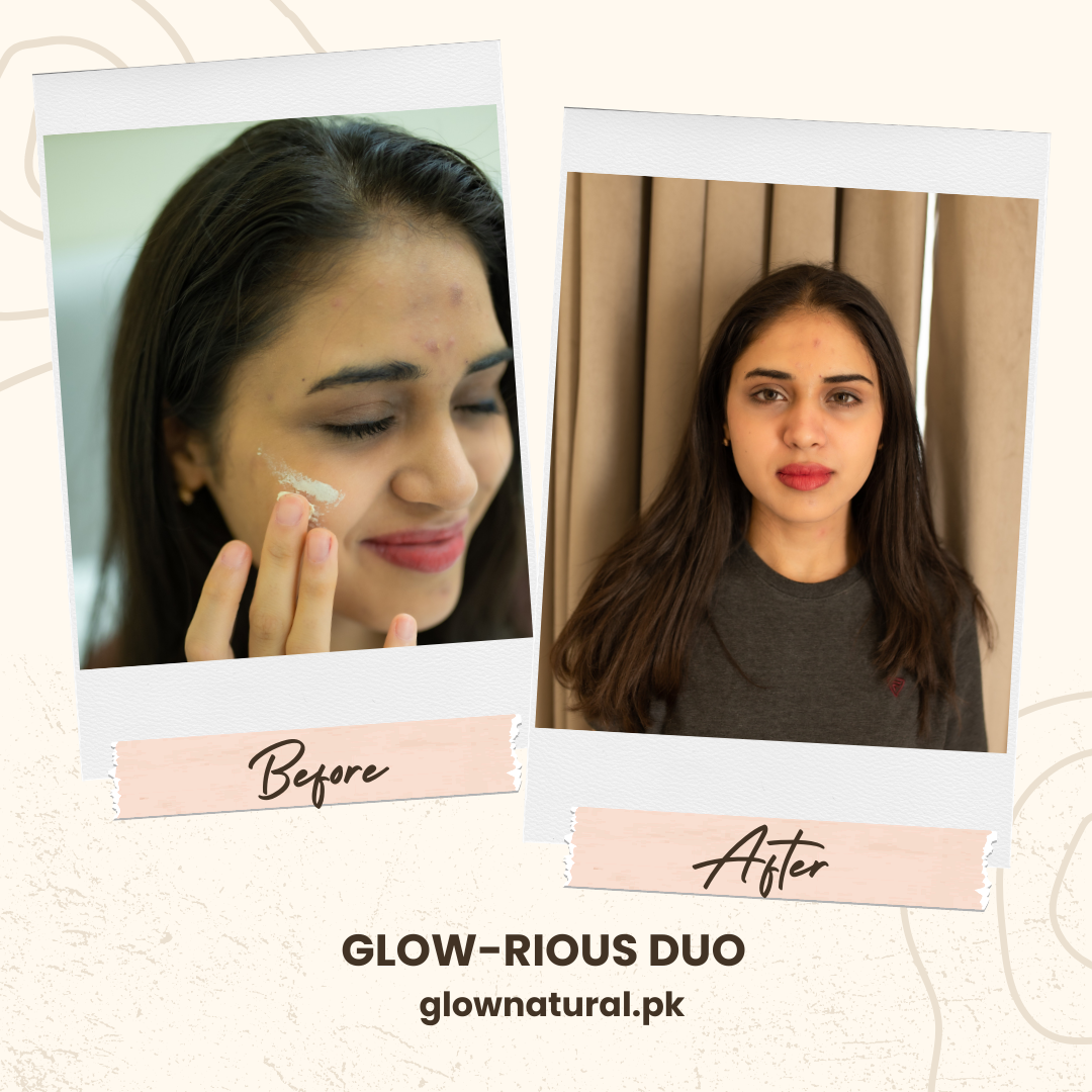 Glow-rious Duo