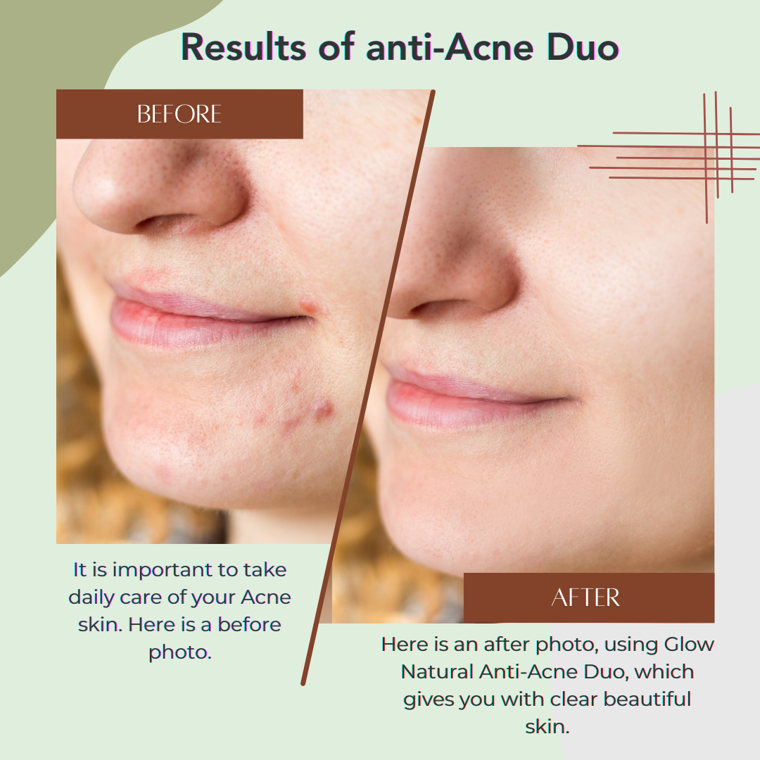Anti-Acne Duo
